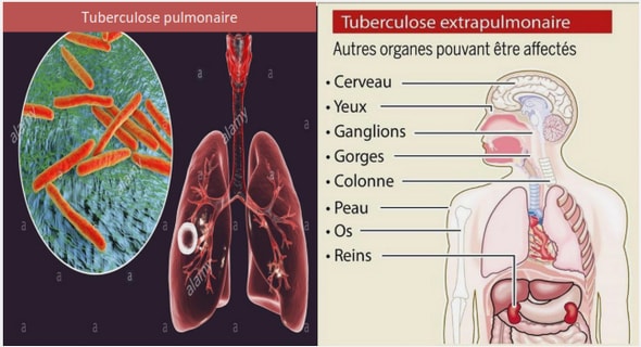 Radiologie en médecine du furet