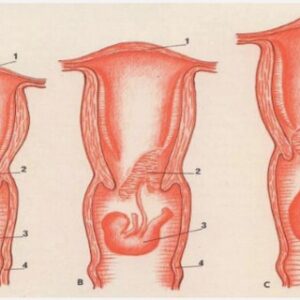 Grossesse et anorexie mentale et boulimie