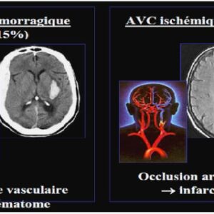Technologue en imagerie médicale